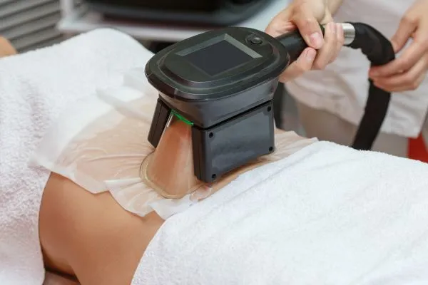 Image of person having fat freezing treatment to help weight gain Shettleston