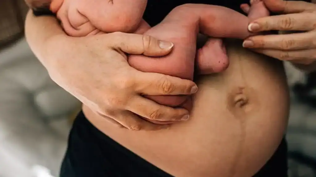 Why Is My Stomach Still Big After Pregnancy Shettleston?